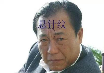 印堂有很多竖纹面相的人