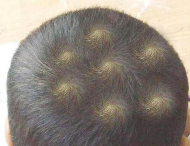 男孩头上三个旋命理