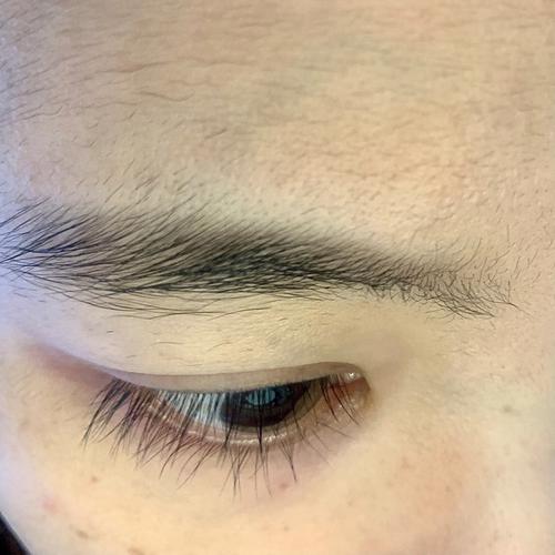 眼睛上长朱砂痣位置