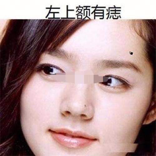 女人身上长这些痣千万不能娶