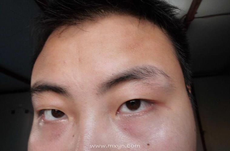 梦见眉毛没有了