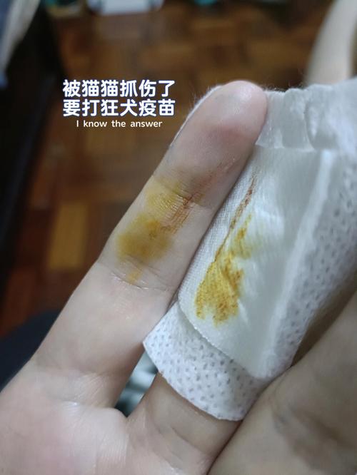 女人梦见被猫抓伤出血