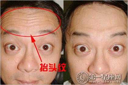 抬头纹重的男人好吗?思虑容易过多?