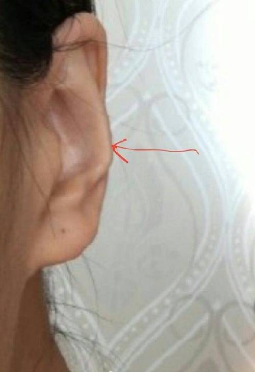 耳廓宽大的女人很有福气吗?