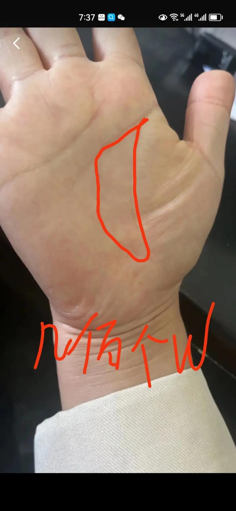 元宝纹手相的人命运怎么样