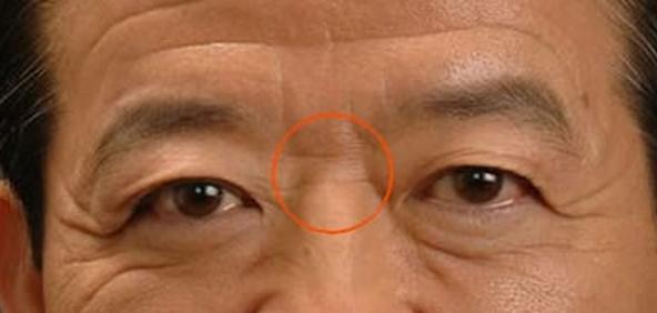 山根有横纹的男人命运如何
