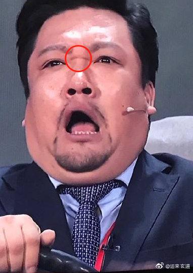 男人山根低婚姻如何