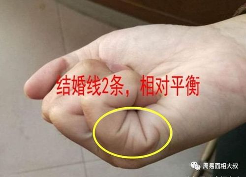 两条平行等长的婚姻线