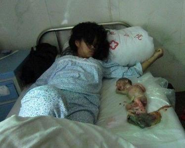 梦见打胎