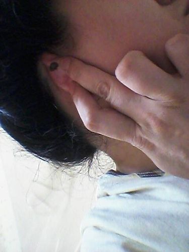 耳背有痣的男人