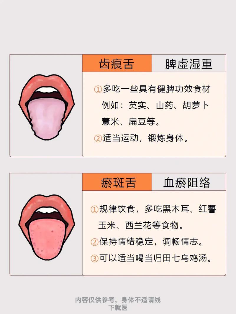从舌头看健康 怎样看舌头知健康