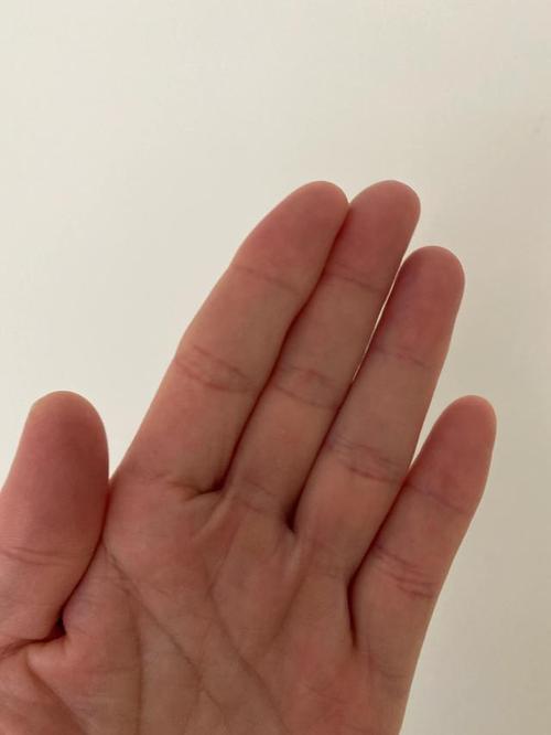 食指无名指一样长少见