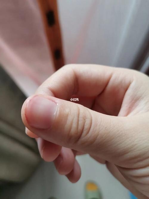 梦见自己把指甲剪了,梦见指甲剪短了