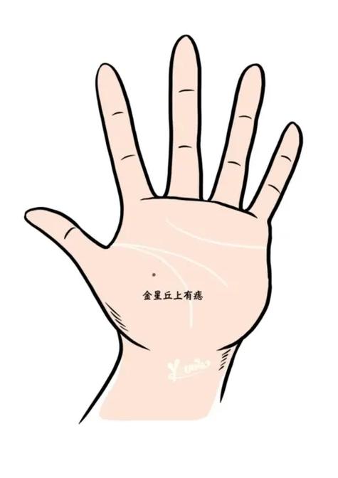 手掌有痣代表什么意思