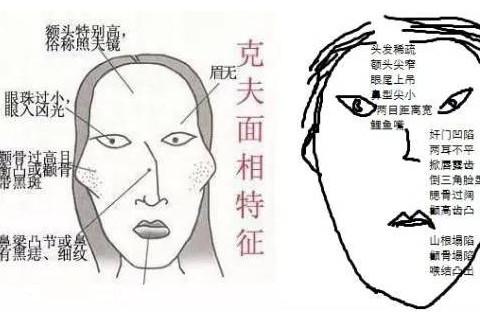 女人额头高是不是克夫