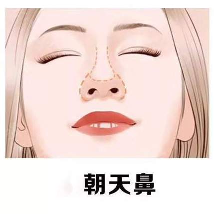 为什么面相怕朝天鼻?