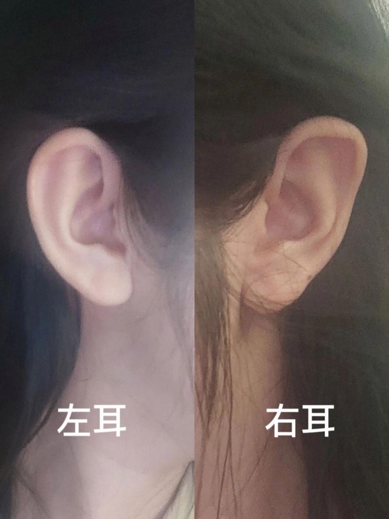 耳朵一大一小代表什么