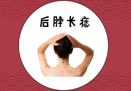 女孩脖子福气痣代表什么