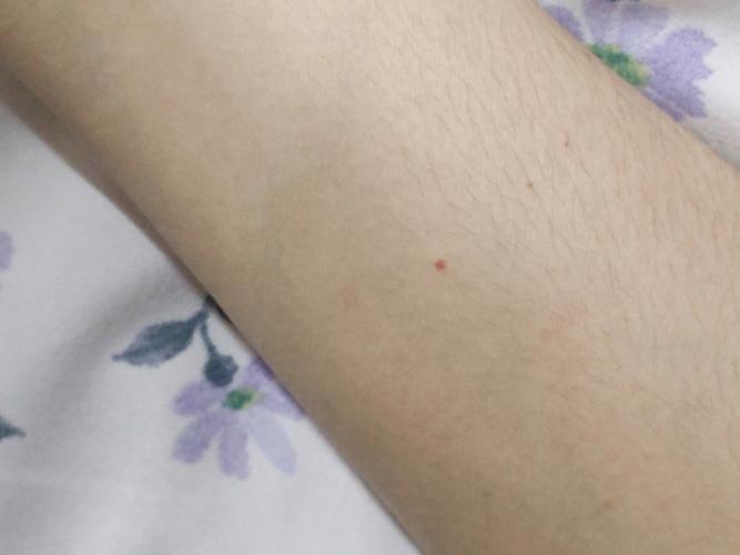 手臂不同位置的朱砂痣代表什么,命运如何