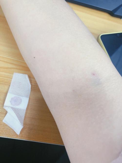 女人梦见自己被抽血