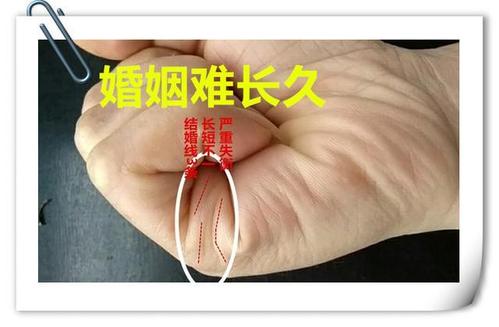 配偶久病身亡!婚姻线末端下垂好吗?