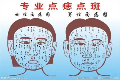 面部痣可以随便点掉吗