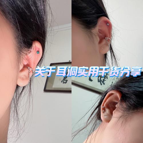 耳洞愈合运气会回来吗