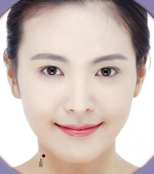 女生右边脖子有痣