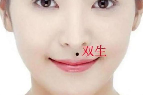 女人痣相双生是什么意思?很可能会生双胞胎!