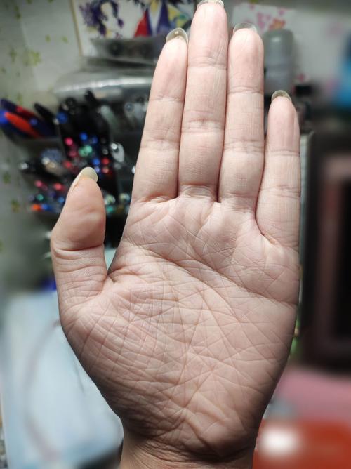 手掌皮肤粗糙