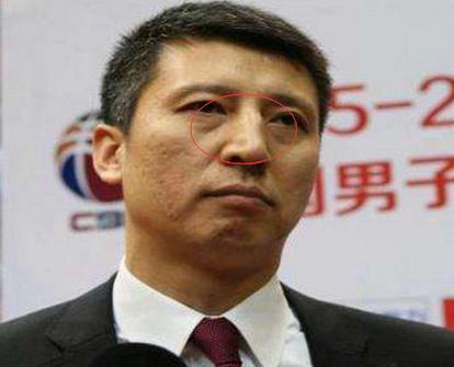 男人驼峰鼻面相