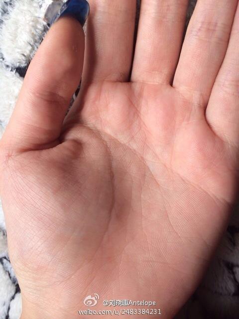 女孩右手断掌纹