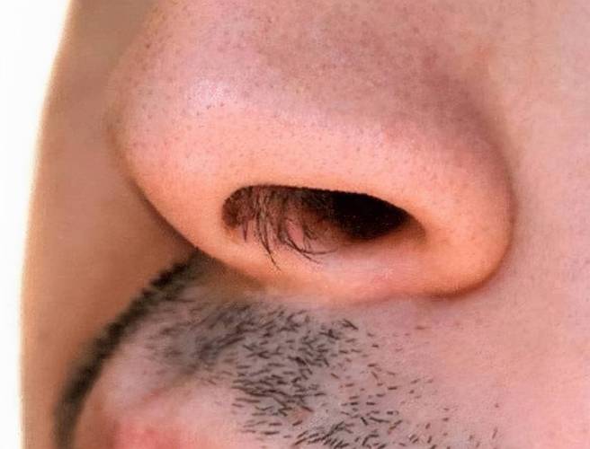鼻毛外露的男人在职场上运势如何