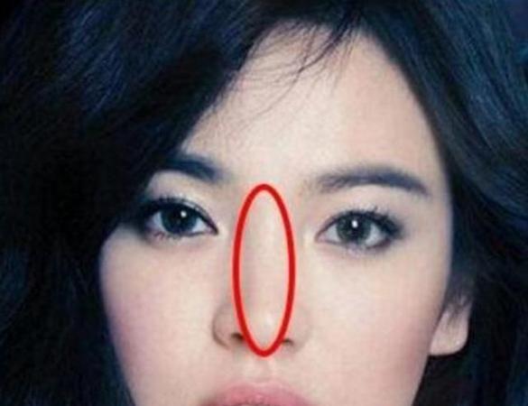 细数狮子鼻面相的女明星