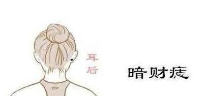 女人耳朵后面有痣图解