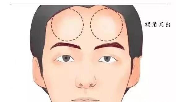 天生额头有两个角面相好吗