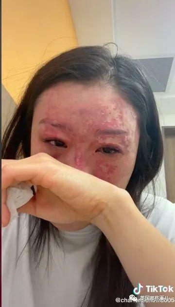 梦见毁容怎么回事