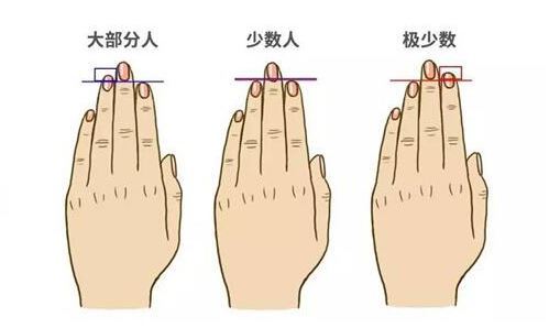 无名指长的人会有同性恋倾向吗