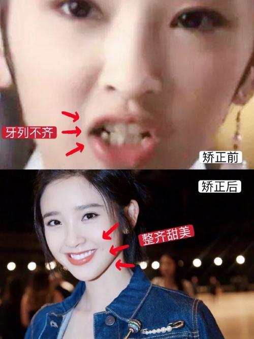 笑起来嘴巴往一边歪的面相