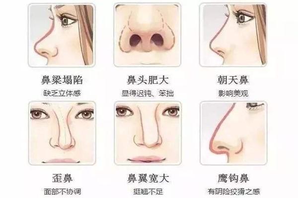 女人是否聚财命看鼻子