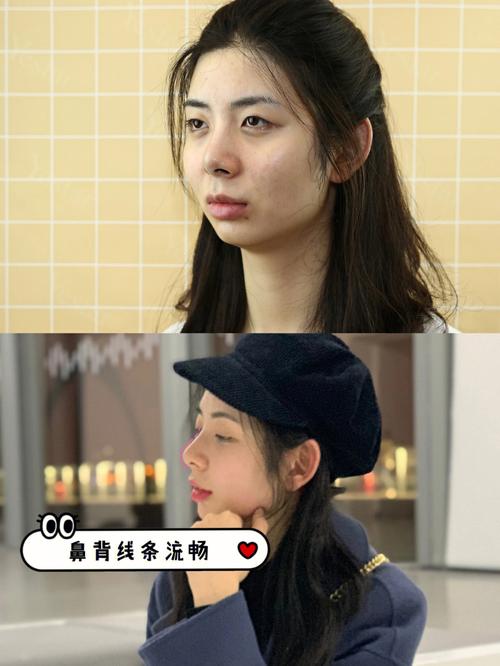 驼峰鼻的面相特征怎么样