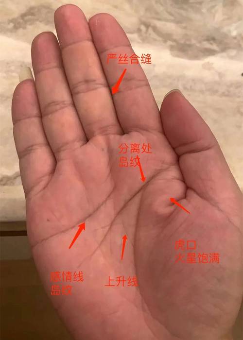 通过手皮肤来看你的运势