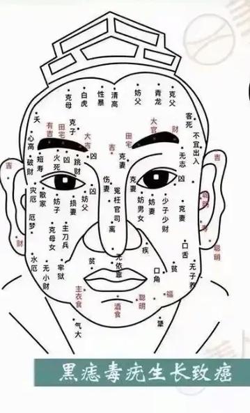 面部痣相的寓意