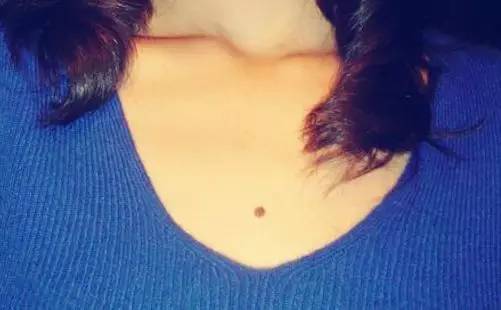 胸口长痣的女人命苦吗?