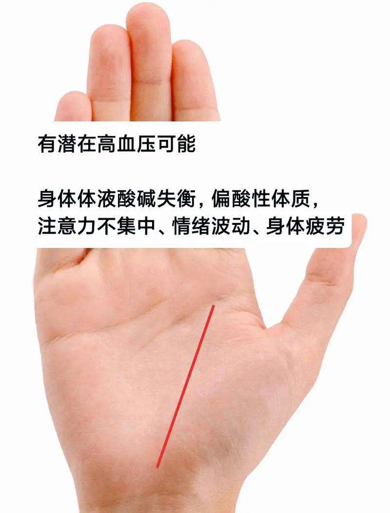 掌纹看健康 身体健康状况与否 看掌纹就可得知