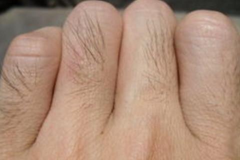 梦见手上长毛周公解梦,梦见手上长毛是什么意思?