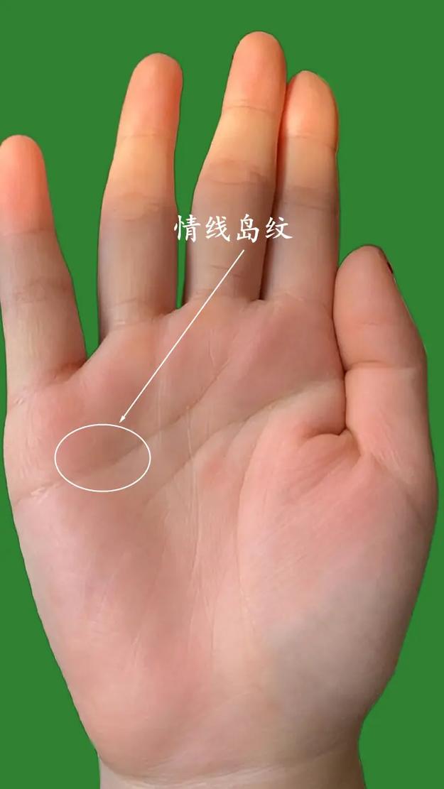 生命线尾部分叉代表什么