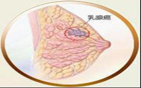梦见乳房有肿块