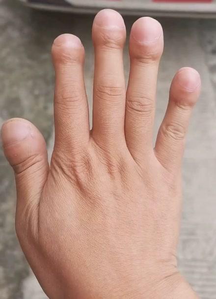 指尖很细但是手指根部很粗