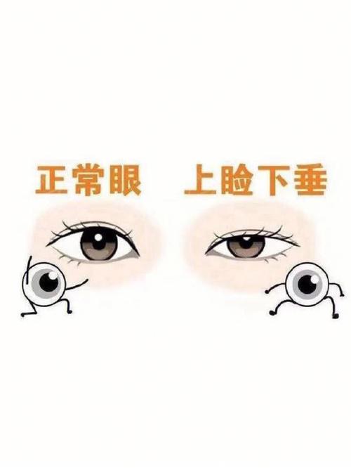 双眼无神的人如何改善财运
